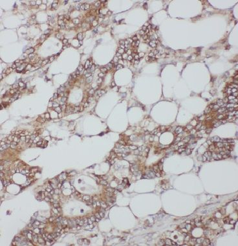 IPO4 Rabbit Polyclonal Antibody