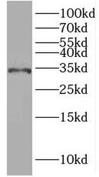 IQCK Antibody