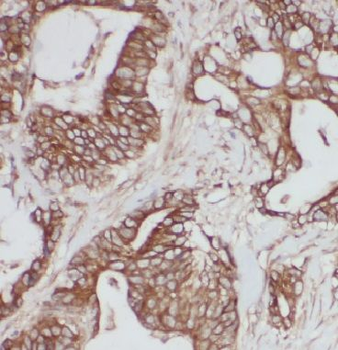 IQCK Rabbit Polyclonal Antibody