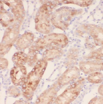 IQSEC2 Antibody