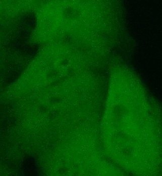 IRAK1 Rabbit Polyclonal Antibody