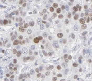 IRAK1 Rabbit Polyclonal Antibody