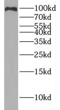 IREB2 Antibody