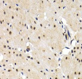 IRF2 Rabbit Polyclonal Antibody