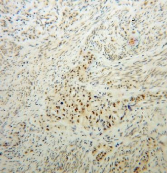 IRF2BP1 Rabbit Polyclonal Antibody