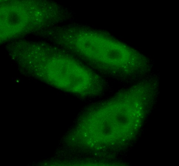 IRF2BP2 Rabbit Polyclonal Antibody