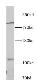 IRS1 Rabbit Polyclonal Antibody