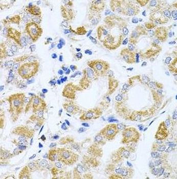 IRS1 Rabbit Polyclonal Antibody