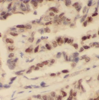 IST1 Rabbit Polyclonal Antibody
