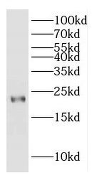ITGB1BP1 Antibody