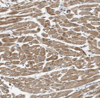ITGB1BP1 Rabbit Polyclonal Antibody