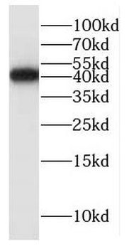 ITGB1BP2 Antibody