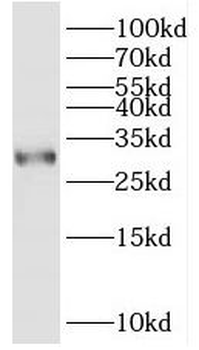 ITM2C Antibody