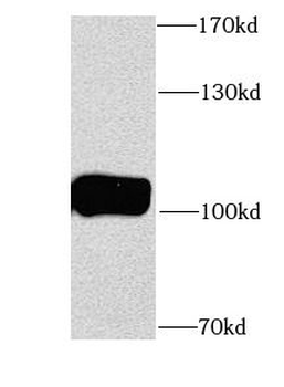 ITPKB Antibody