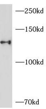 JAK2 Rabbit Polyclonal Antibody