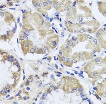 JAK2 Rabbit Polyclonal Antibody