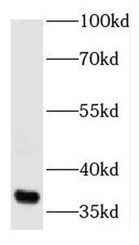AIMP2 Antibody