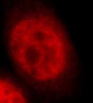JUN Rabbit Polyclonal Antibody