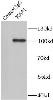 TRIM28 Rabbit Polyclonal Antibody