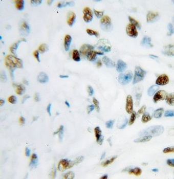 TRIM28 Rabbit Polyclonal Antibody