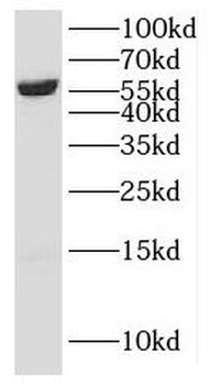 KAT5 Rabbit Polyclonal Antibody