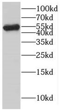KATNAL1 Antibody