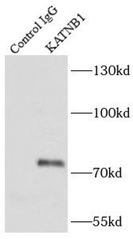 KATNB1 Rabbit Polyclonal Antibody