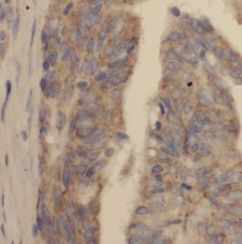 KBTBD2 Rabbit Polyclonal Antibody