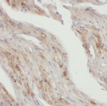 KCNH7 Rabbit Polyclonal Antibody