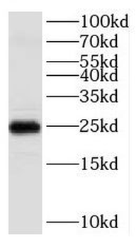 KCNIP1 Antibody