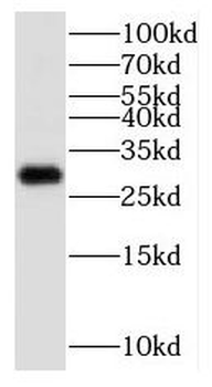KCNIP3 Rabbit Polyclonal Antibody