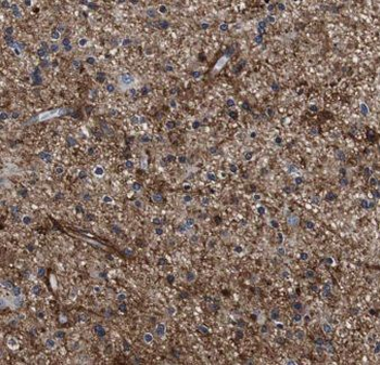 KCNIP3 Rabbit Polyclonal Antibody