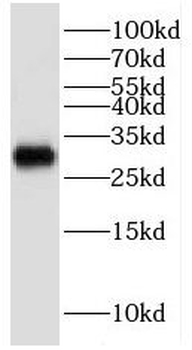 KCNIP4 Antibody