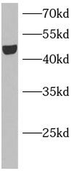 KCNJ5 Antibody
