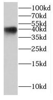 KCTD12 Antibody