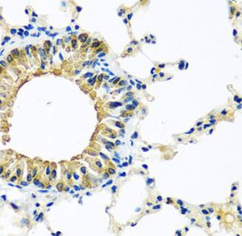 KCTD15 Rabbit Polyclonal Antibody