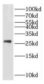 KCTD5 Antibody
