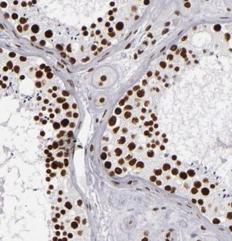 POGLUT3 Rabbit Polyclonal Antibody
