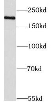 KDM3B Antibody