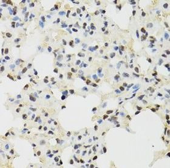KDM4A Rabbit Polyclonal Antibody