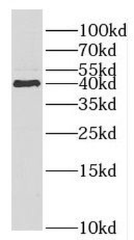 KIAA0087 Rabbit Polyclonal Antibody