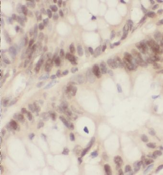 KIAA0087 Rabbit Polyclonal Antibody