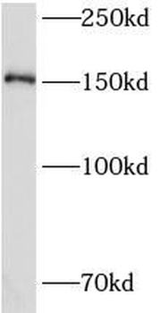 CEMIP Antibody