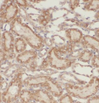 KIF12 Rabbit Polyclonal Antibody
