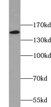 KIF15 Antibody