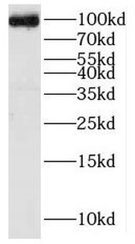 KIF2A Antibody