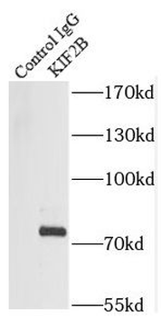 KIF2B Rabbit Polyclonal Antibody