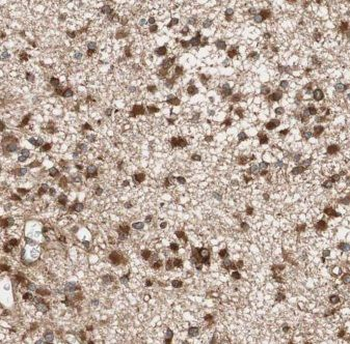 KIF3C Rabbit Polyclonal Antibody