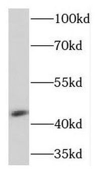 KCNJ13 Rabbit Polyclonal Antibody