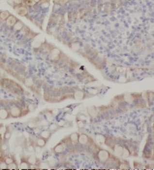 KCNJ13 Rabbit Polyclonal Antibody